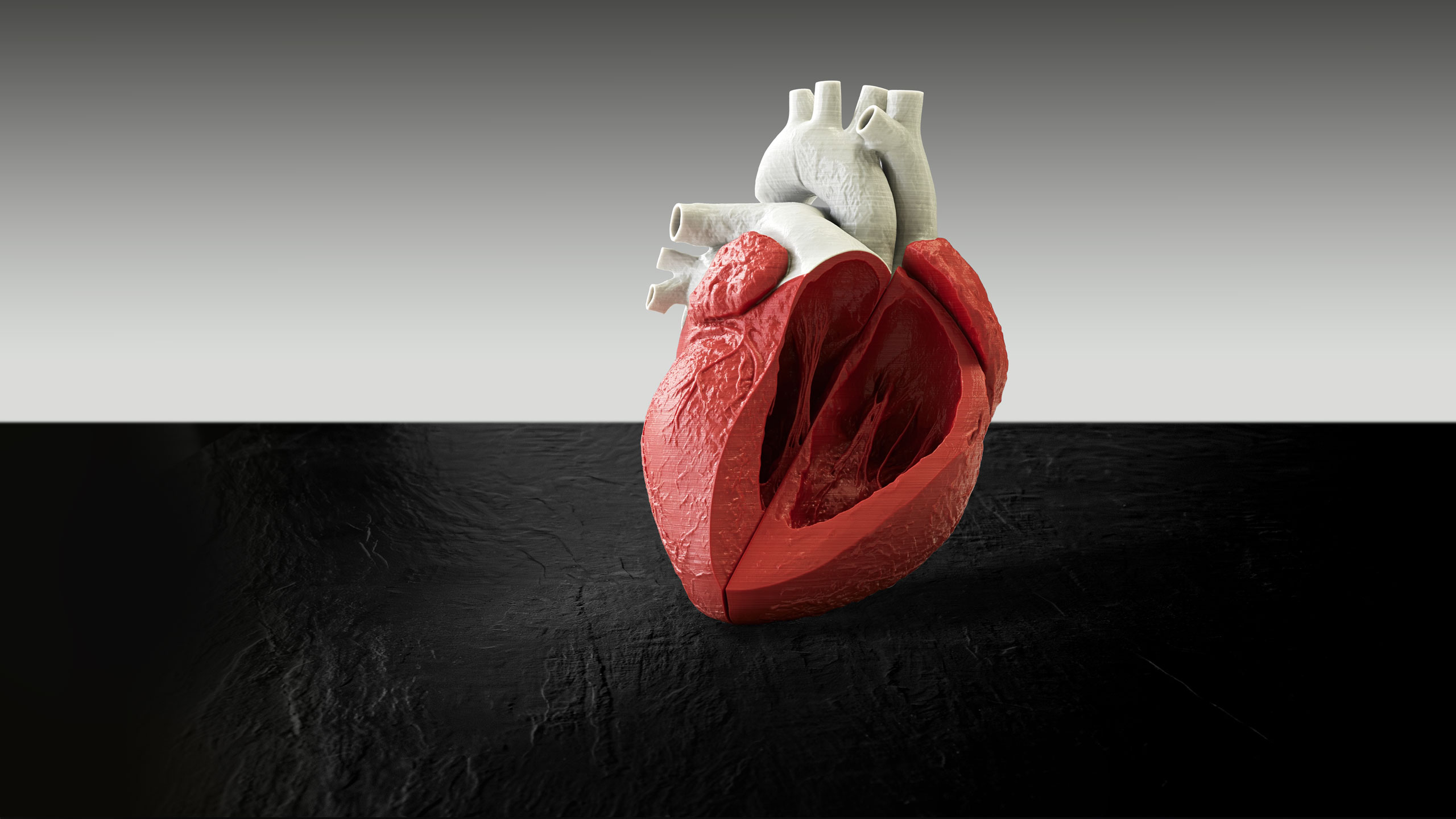 3D-Druck Medizintechnik - Modell eines offenen Herzen - formscale